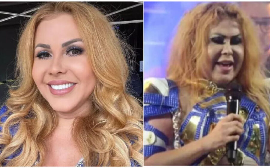 Covid causa inchaço? Entenda sequelas relatadas por Joelma