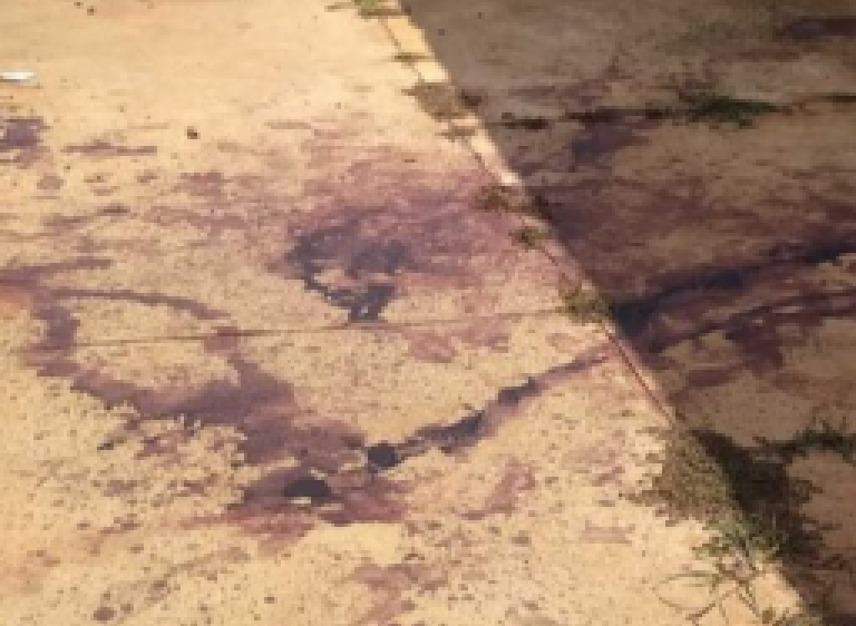 Mulher tenta separar briga e leva facada no pescoço em Campo Grande