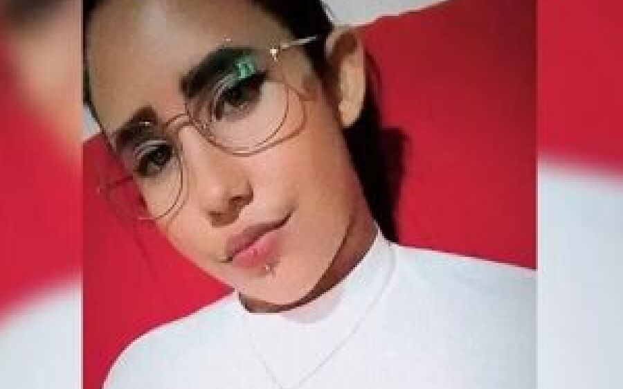 Jovem de 20 anos morre por infecção após colocar piercing nos lábios