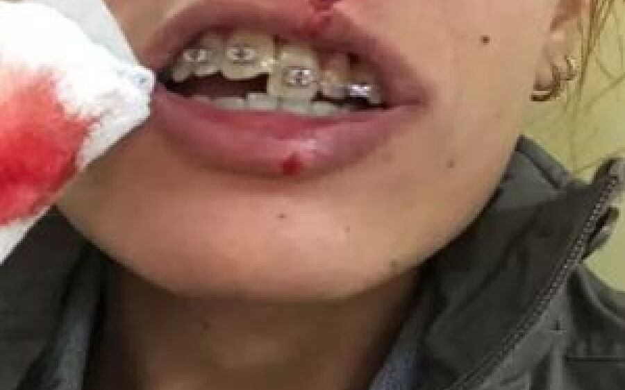 Música de Eduardo Costa é estopim para briga e dois dentes afundados