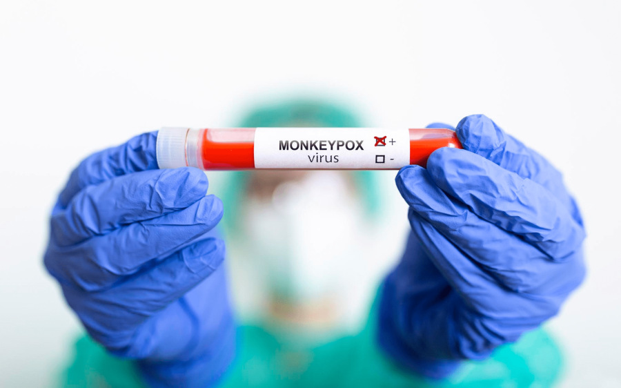 Anvisa alerta clínicas de reprodução assistida sobre varíola dos macacos