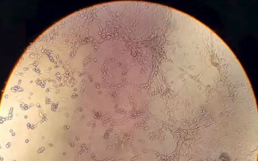 Fiocruz isola vírus Monkeypox e registra imagens inéditas que mostram replicação ‘com facilidade’