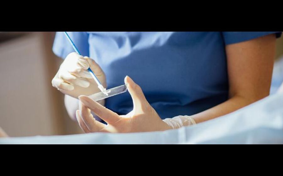 Jovens de 18 a 25 anos podem participar de pesquisa sobre HPV na UFMS