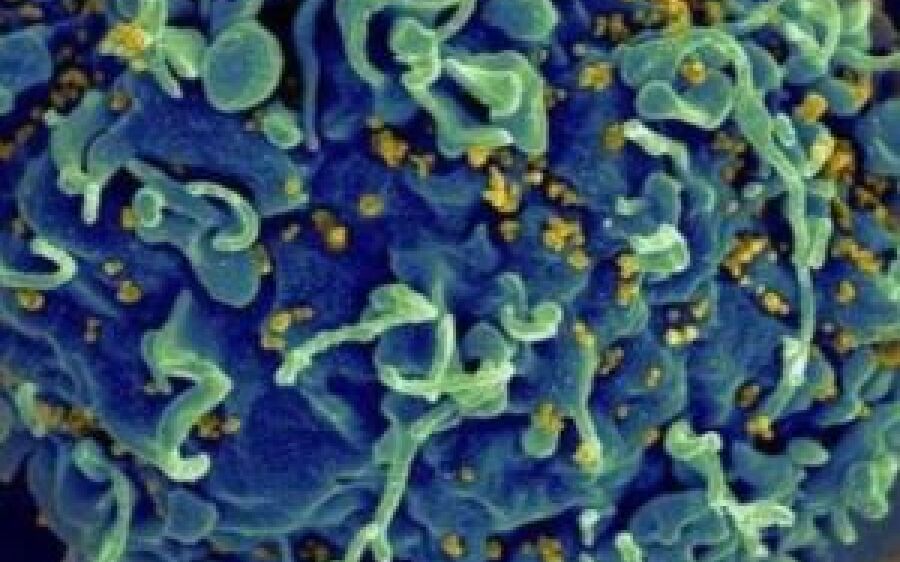 Homem de 53 anos é o quinto paciente curado do HIV após transplante de células-tronco