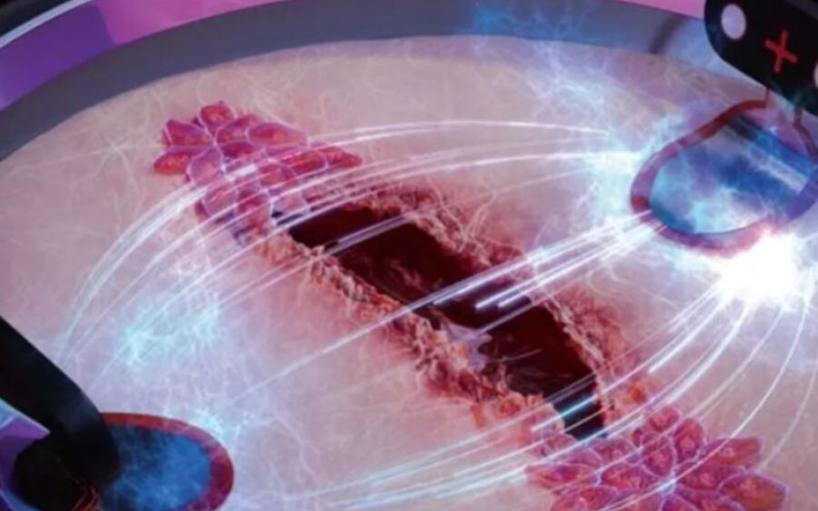 Cientistas criam biochip capaz de acelerar cicatrização de feridas