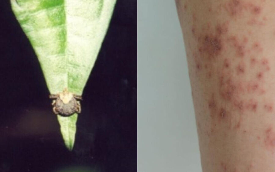 Carrapatos com febre maculosa estão em Mato Grosso do Sul e podem infectar pets, entenda