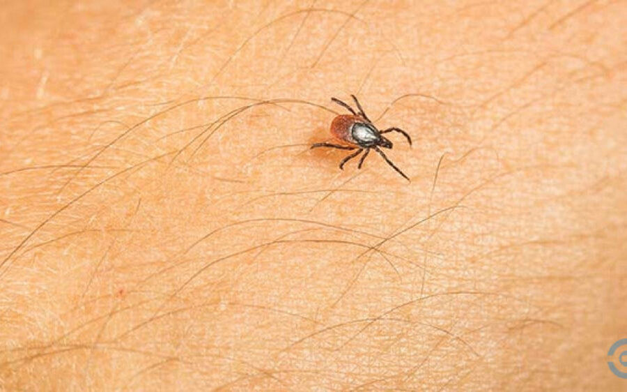 Bebê é 1º caso suspeito de febre maculosa em Campo Grande