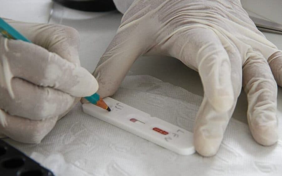 MS registra 139 novos casos de covid e três mortes em sete dias