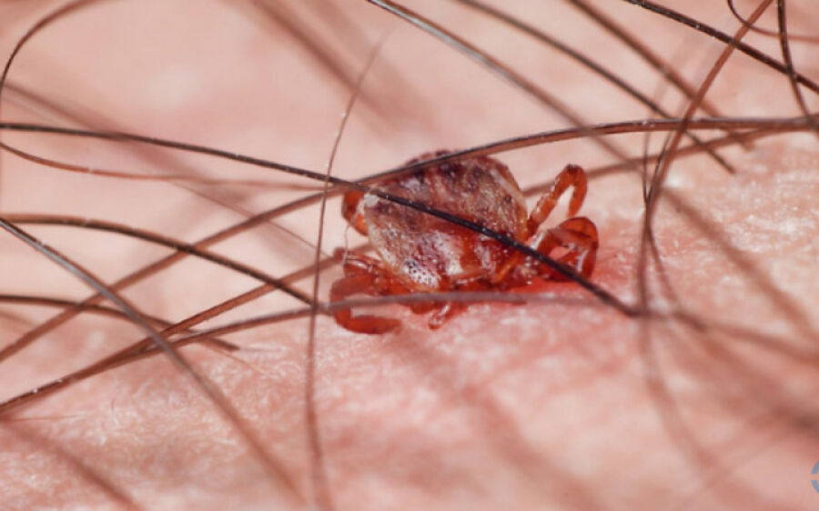 Mato Grosso do Sul soma 27 suspeitas de febre maculosa, duas já descartadas
