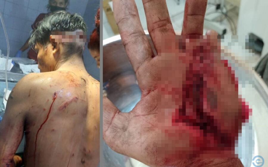 É FAKE! Ataque de onça-pintada a jovem não aconteceu em Coxim