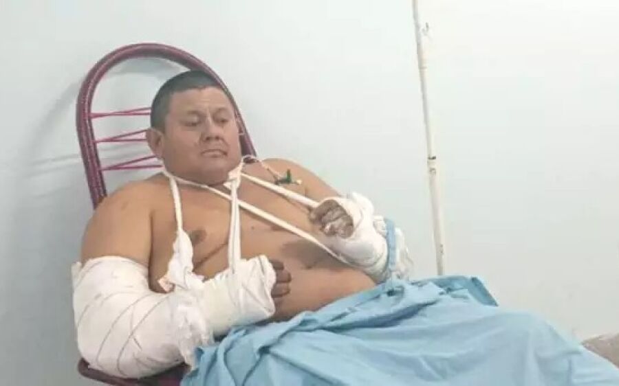 A três dias de aniversário, trabalhador atacado por onça diz que nasceu de novo