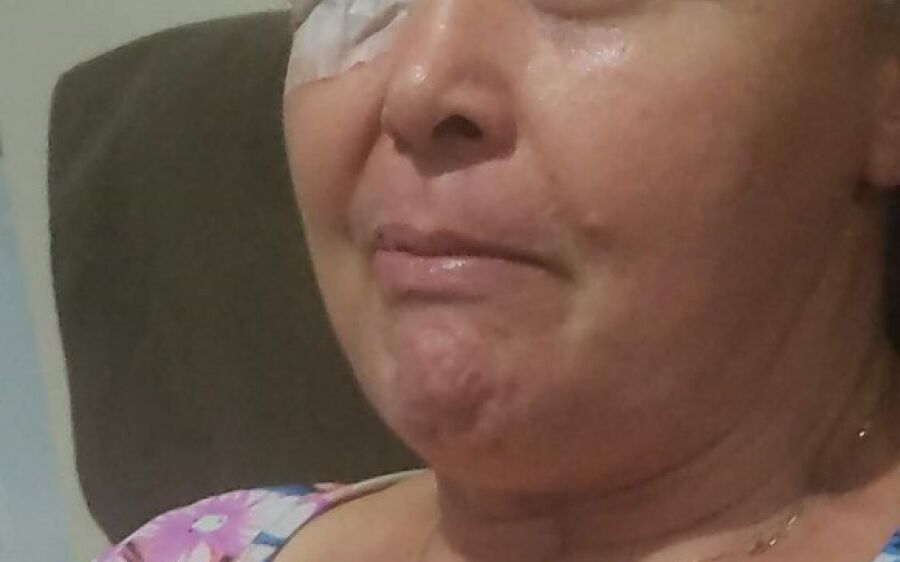 Ajude Cida a vencer as sequelas de 3 AVCs, ela precisa de cirurgias e tratamento