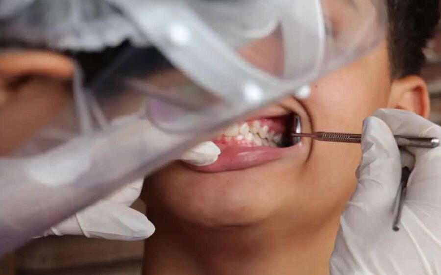 Brasil tem 45% de cobertura em saúde bucal; meta é chegar a 70%