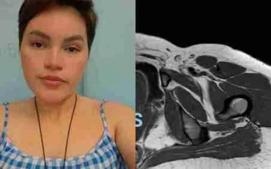 Moradora de São Gabriel do Oeste busca ajuda para tratamento de saúde