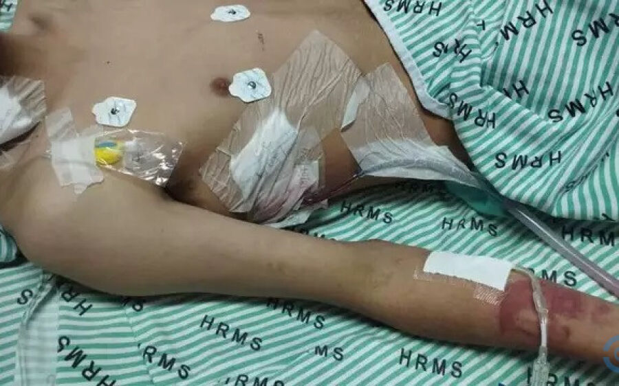 Paulo, jovem de 22 anos perde parte do pulmão por usar vape e narguile