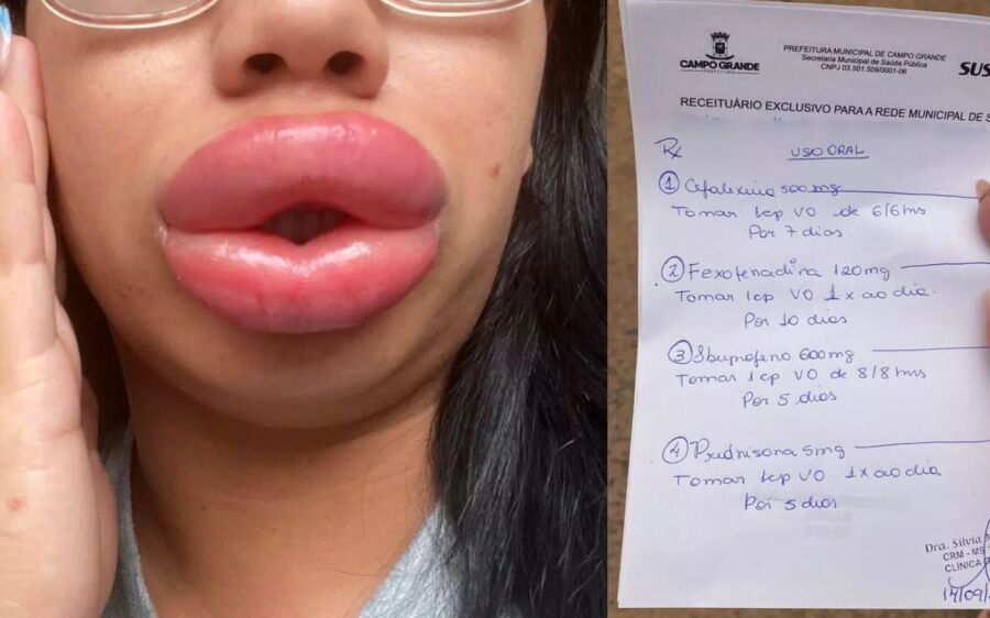 Estudante de biomedicina que promete 'bocão da Angelina Jolie' fere paciente modelo com ácido