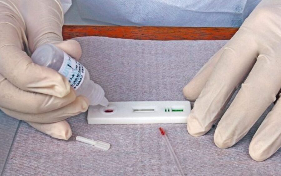 Casos de Covid-19 voltam a crescer no MS e deixam população em alerta
